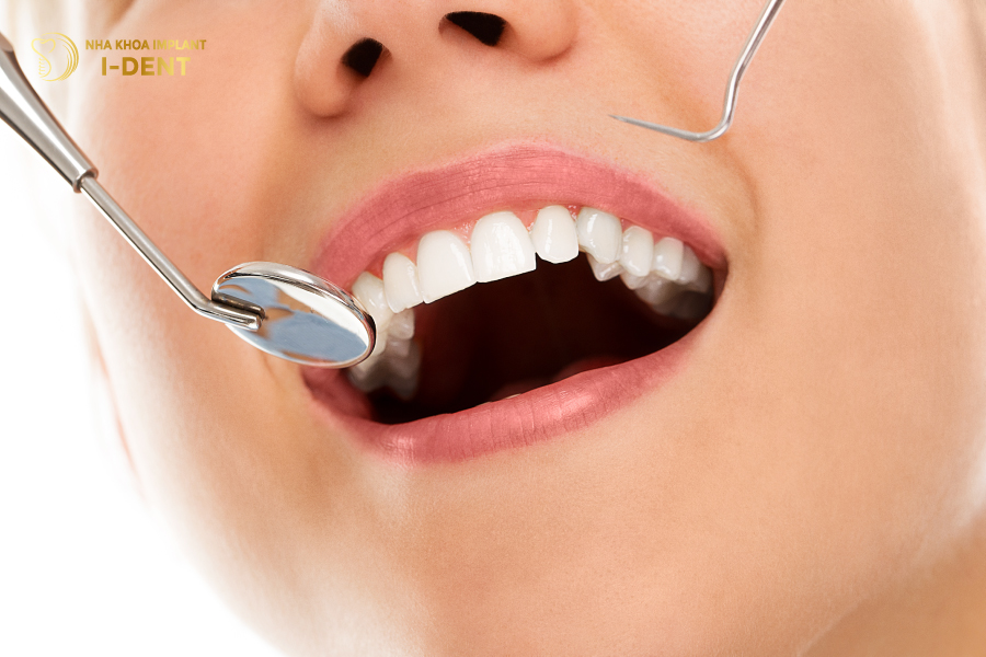 Tẩy răng cần thực hiện khoảng 1 - 2 lần/ năm để có kết quả tốt nhất 
