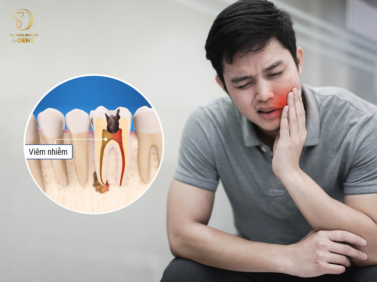 Răng bị sâu gây nên tình trạng nhức răng