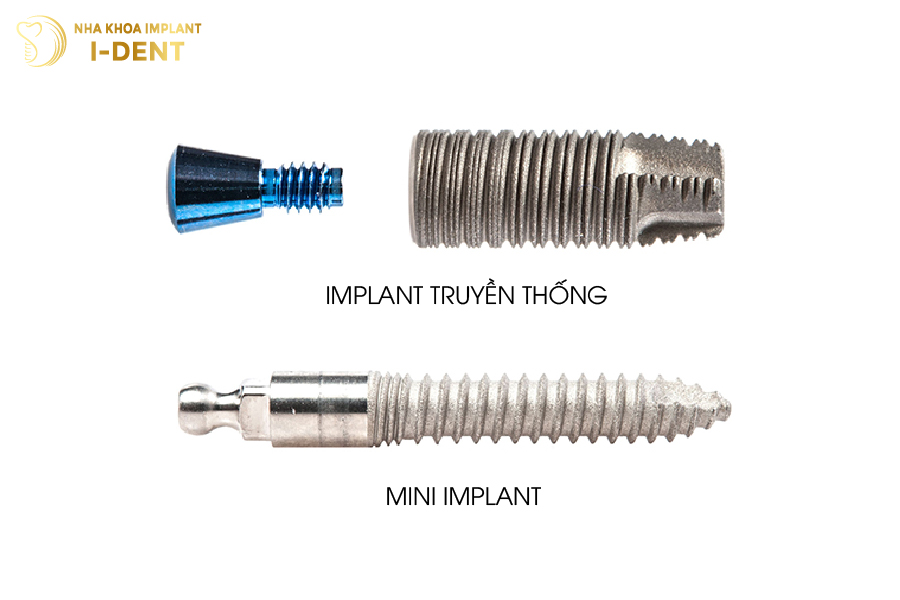 Kích thước của trụ mini Implant so với trụ thông thường