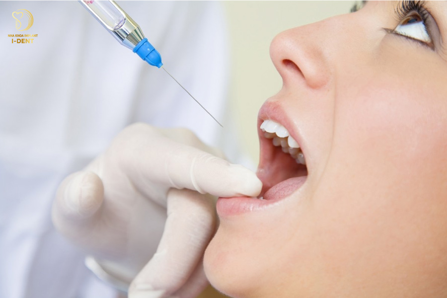 Tiến hành gây tê vùng điều trị và mài cùi răng