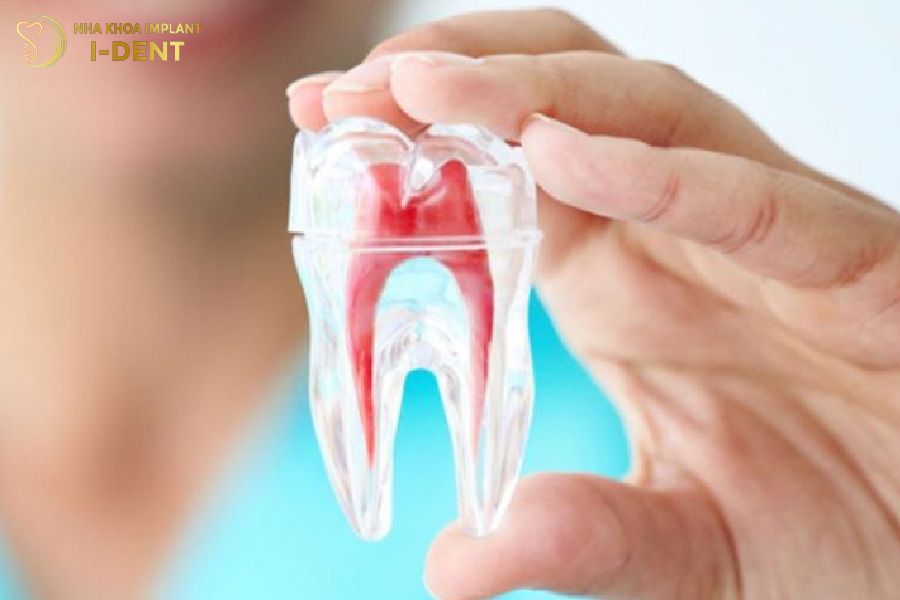Cần điều trị triệt để các bệnh lý răng miệng trước khi bọc sứ
