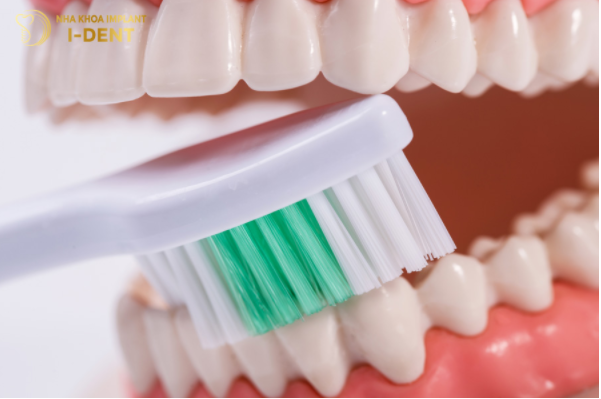 Nên có chế độ chăm sóc răng miệng hợp lý sau khi bọc răng sứ