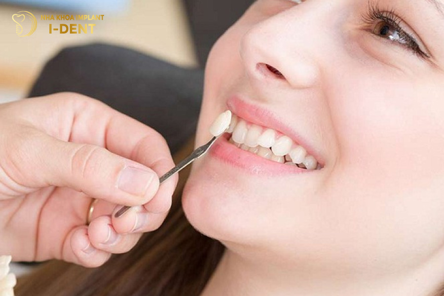 Bọc răng sứ cho răng khấp khểnh sẽ trắng sáng và đều màu hơn