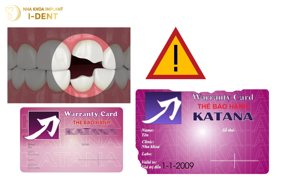 Những trường hợp thẻ bảo hành răng sứ katana không có hiệu lực