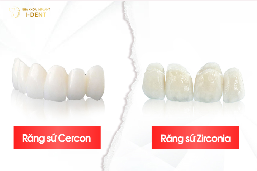 Tổng quan về răng sứ Zirconia và Cercon