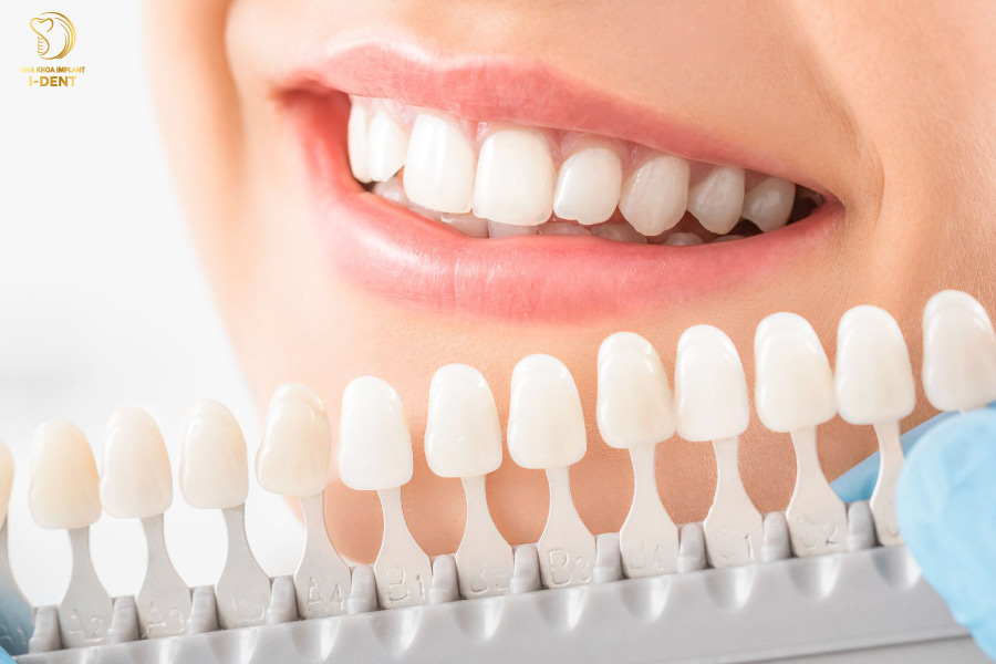 Tráng răng sứ không mài răng, đem đến hàm răng đều đặn, trắng sáng