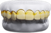 Răng bị xỉn màu, nhiễm kháng sinh tetracylin, ngả vàng, không thể tẩy trắng được
