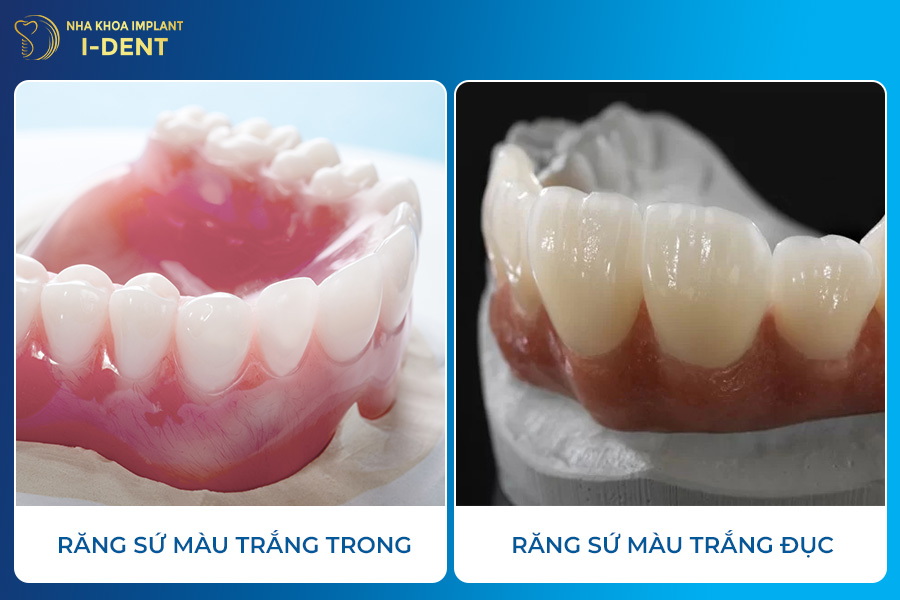 Nên chọn màu răng sứ nào tự nhiên nhất? màu răng sứ tự nhiên nhất