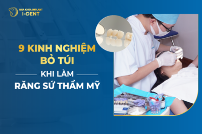9 Kinh Nghiệm Bỏ Túi Khi Làm Răng Sứ Thẩm Mỹ