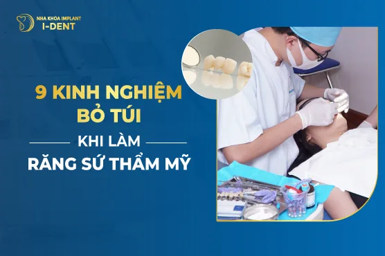 9 Kinh Nghiệm Bỏ Túi Khi Làm Răng Sứ Thẩm Mỹ