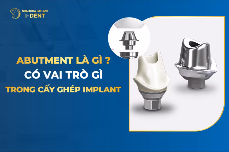 Abutment Implant Là Gì Có Vai Trò Gì Trong Cấy Ghép Implant