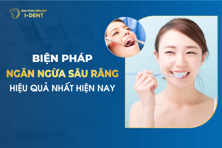 Bắt Buộc Nhổ Răng Nếu Gặp Phải Những Trường Hợp Này
