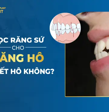 Bọc Răng Sứ Cho Răng Hô Có Hết Hô Không?