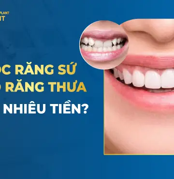 Bọc Răng Sứ Cho Răng Thưa Bao Nhiêu Tiền-