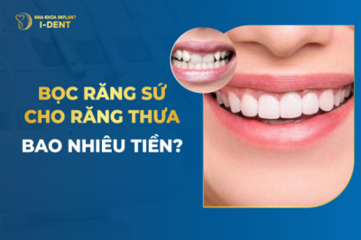 Bọc Răng Sứ Cho Răng Thưa Bao Nhiêu Tiền-