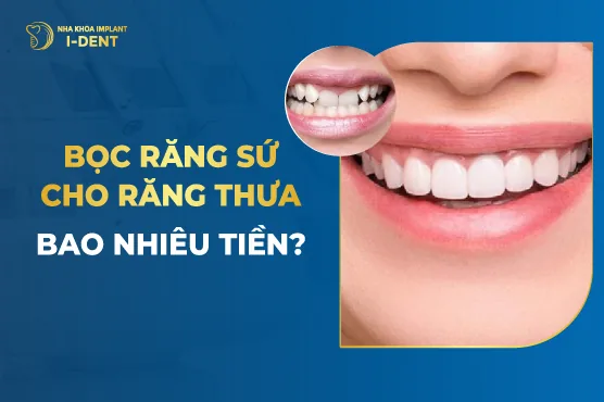 Bọc Răng Sứ Cho Răng Thưa Bao Nhiêu Tiền-