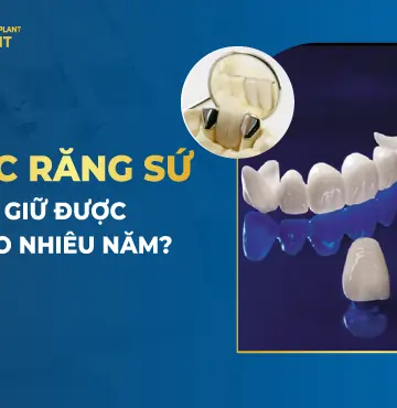 bọc răng sứ được bao lâu