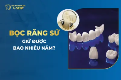 bọc răng sứ được bao lâu