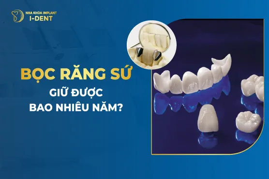 bọc răng sứ được bao lâu