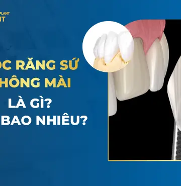 Giá Bọc Răng Sứ Không Mài Bao Nhiêu?