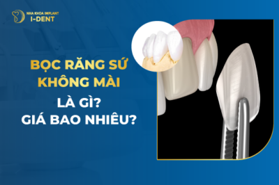 Giá Bọc Răng Sứ Không Mài Bao Nhiêu?