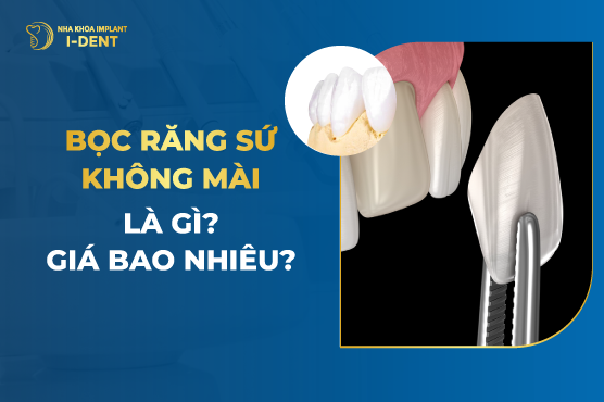 Bọc răng sứ không mài có thể giúp cải thiện vấn đề gì liên quan đến răng?