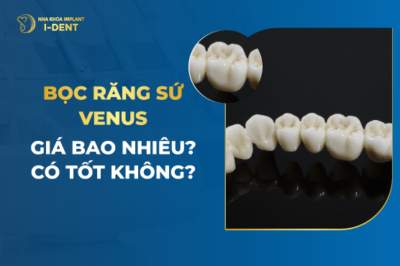 Bọc răng sứ Venus giá bao nhiêu- Có tốt không-