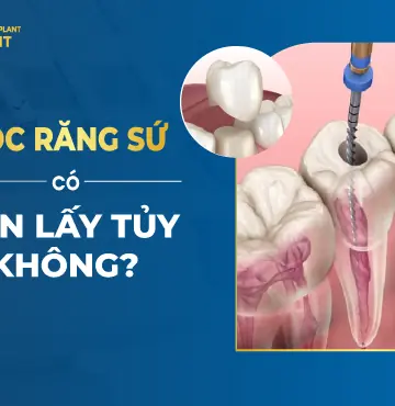 Răng Lấy Tủy Có Nên Bọc Lại Không?