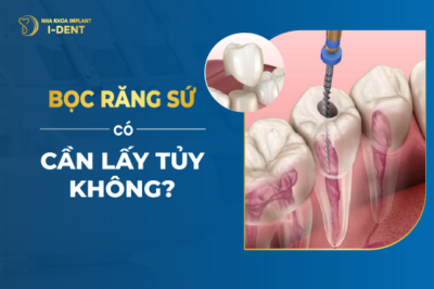 Răng Lấy Tủy Có Nên Bọc Lại Không?