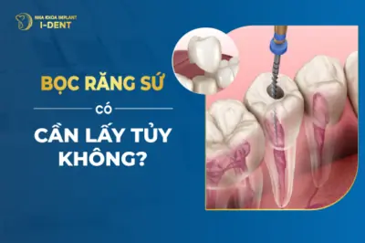 Răng Lấy Tủy Có Nên Bọc Lại Không?