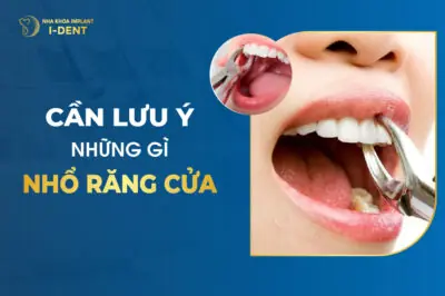 Bắt Buộc Nhổ Răng Nếu Gặp Phải Những Trường Hợp Này