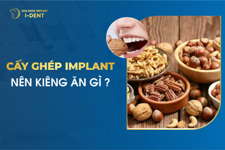 Cấy Ghép Implant Nên Kiêng Ăn Gì ?