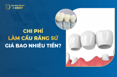 Làm Cầu Răng Sứ Giá Bao Nhiêu Tiền?