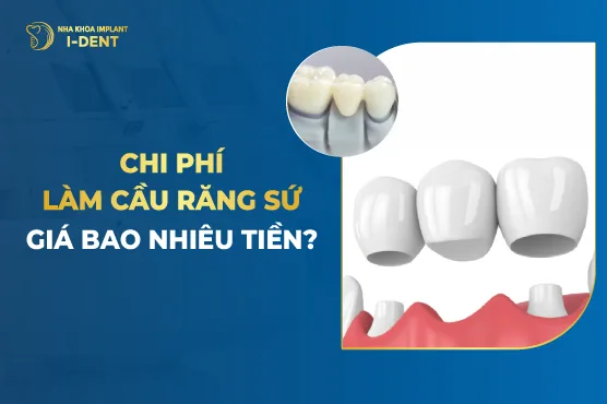 Làm Cầu Răng Sứ Giá Bao Nhiêu Tiền?