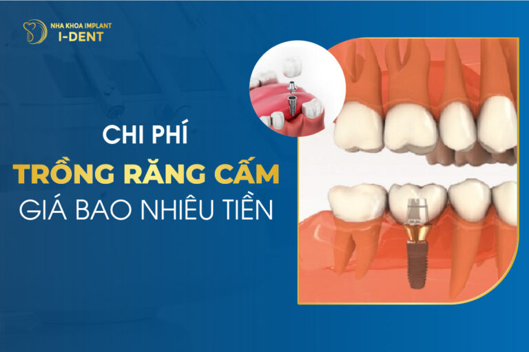 trồng răng cấm giá bao nhiêu
