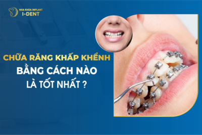 Chữa Răng Khấp Khểnh Bằng Cách Nào Là Tốt Nhất