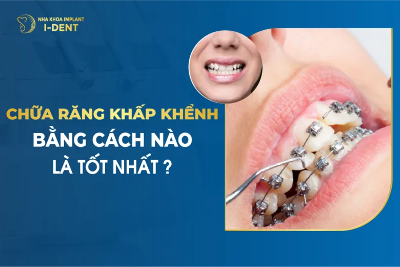 Chữa Răng Khấp Khểnh Bằng Cách Nào Là Tốt Nhất