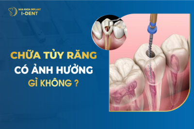 răng lấy tủy bọc sứ được bao lâu