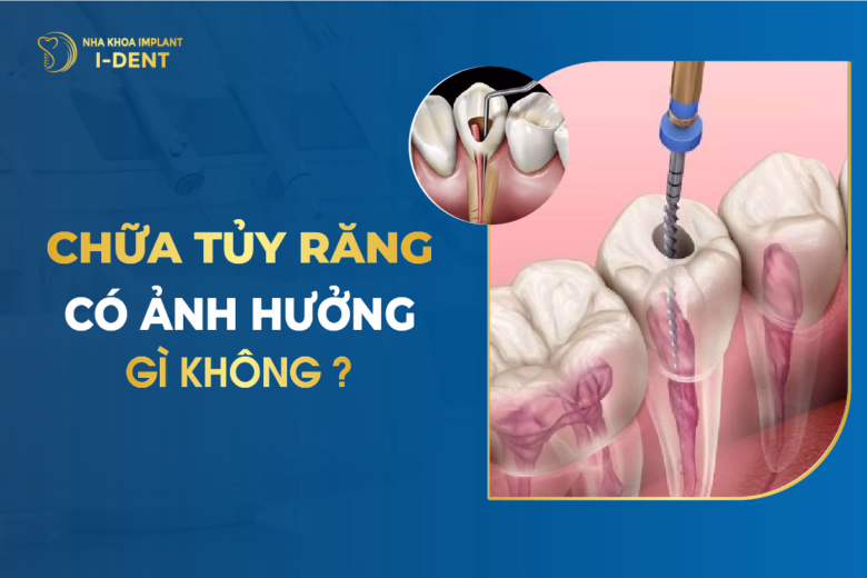 răng lấy tủy bọc sứ được bao lâu