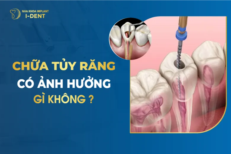 răng lấy tủy bọc sứ được bao lâu