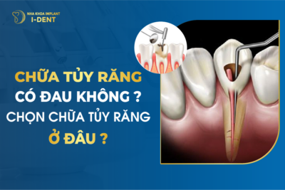 Chữa Tủy Răng Có Đau Không? Chọn Chữa Tủy Răng Ở Đâu?