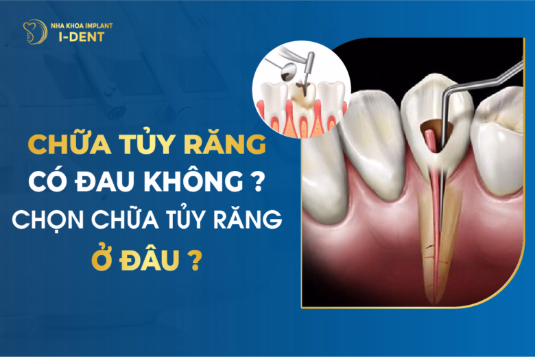 Chữa Tủy Răng Có Đau Không? Chọn Chữa Tủy Răng Ở Đâu?