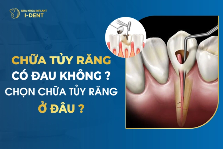 Chữa Tủy Răng Có Đau Không? Chọn Chữa Tủy Răng Ở Đâu?