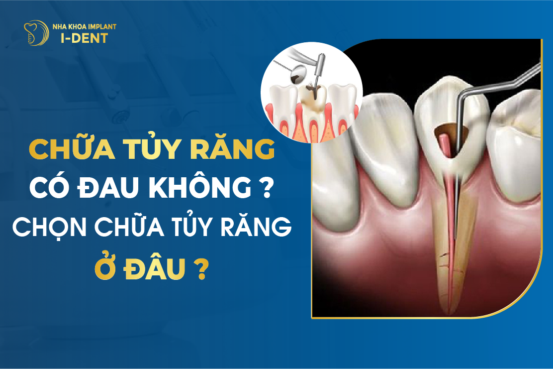 Có phải tất cả các trường hợp lấy tủy răng đều không đau không?
