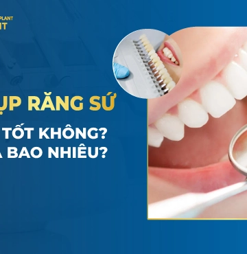 Chụp Răng Sứ Có Tốt Không- Giá Bao Nhiêu-