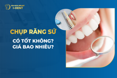 Chụp Răng Sứ Có Tốt Không- Giá Bao Nhiêu-