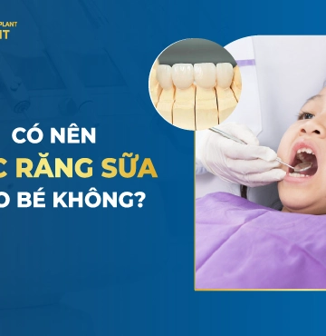 Có Nên Bọc Răng Sữa Cho Bé Không?