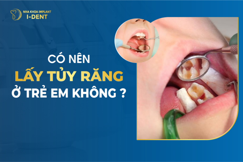 Có Nên Lấy Tủy Răng Ở Trẻ Em Không?