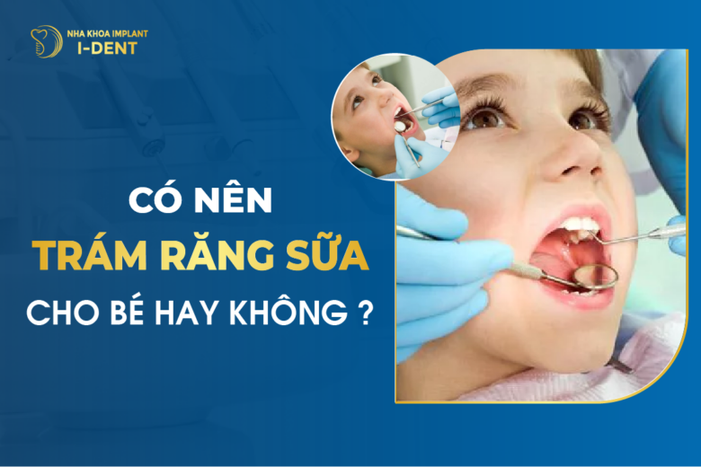 Có Nên Trám Răng Sữa Cho Bé Hay Không?