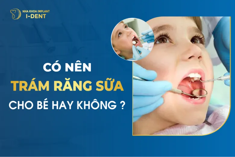 Có Nên Trám Răng Sữa Cho Bé Hay Không